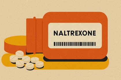 naltrexone